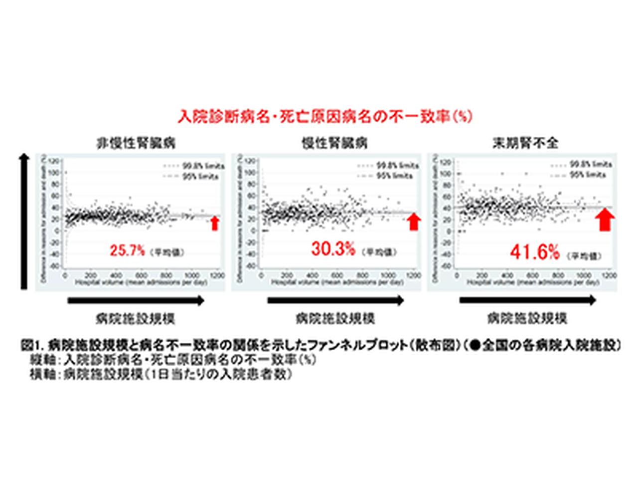 CKD、全国規模の入院データ解析で複雑病態を可視化－東京医歯大