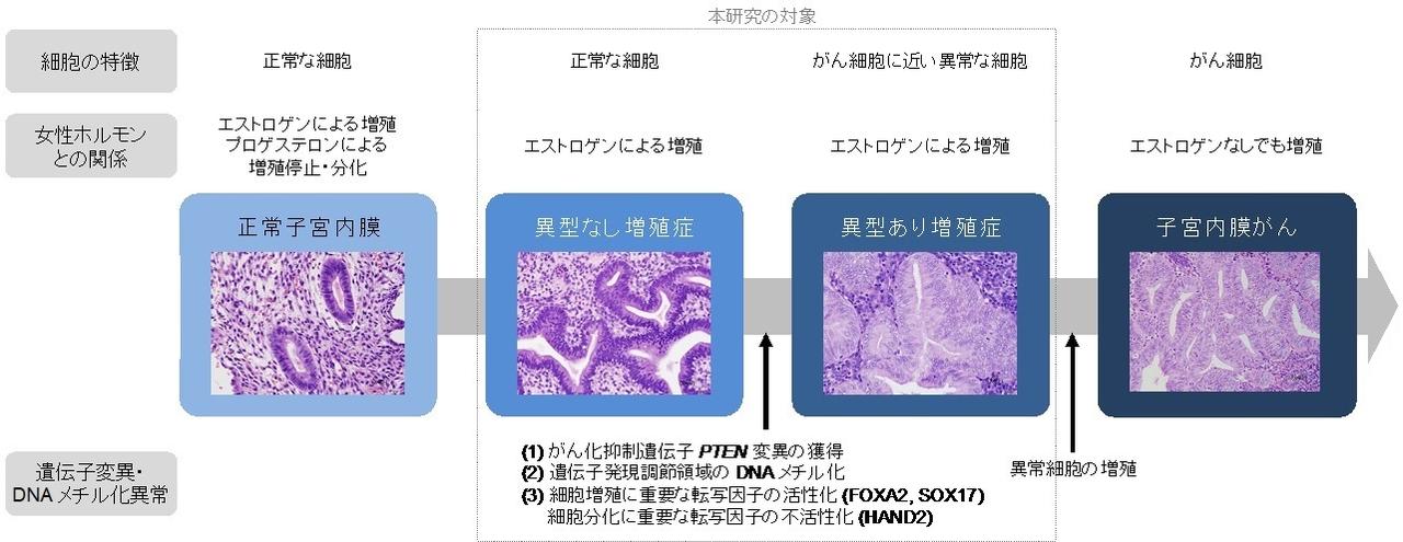 子宮体癌 子宮内膜がん、増殖症での遺伝子変異とDNAメチル化異常を解明