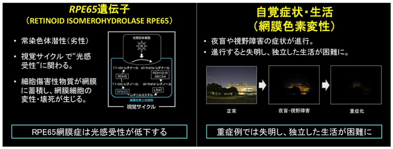 画像: 画像はリリースより