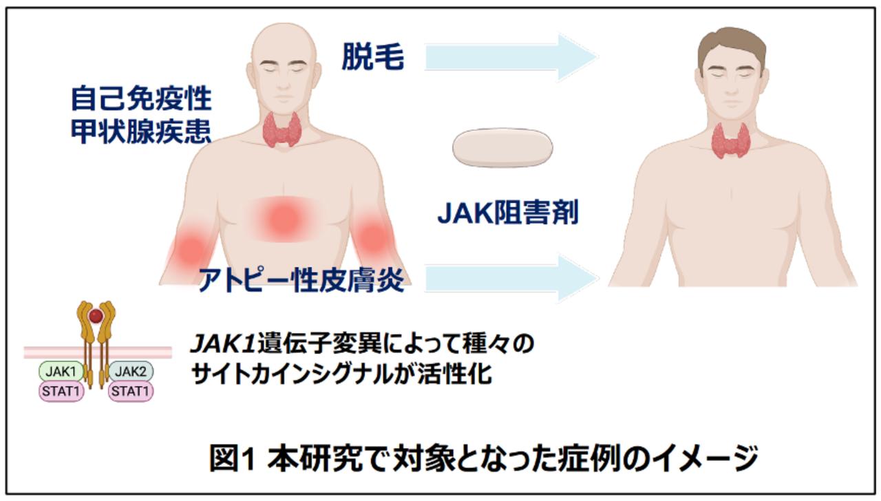 画像: 画像はリリースより