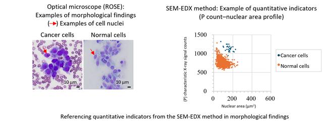 画像: Figure 1: Example of combined use of cytology images (left) and the quantitative indicator P count–nuclear area profile (right) obtained by the SEM-EDX method for application to ROSE (cancer cells are generally characterized by large nuclei and dense nuclear staining)