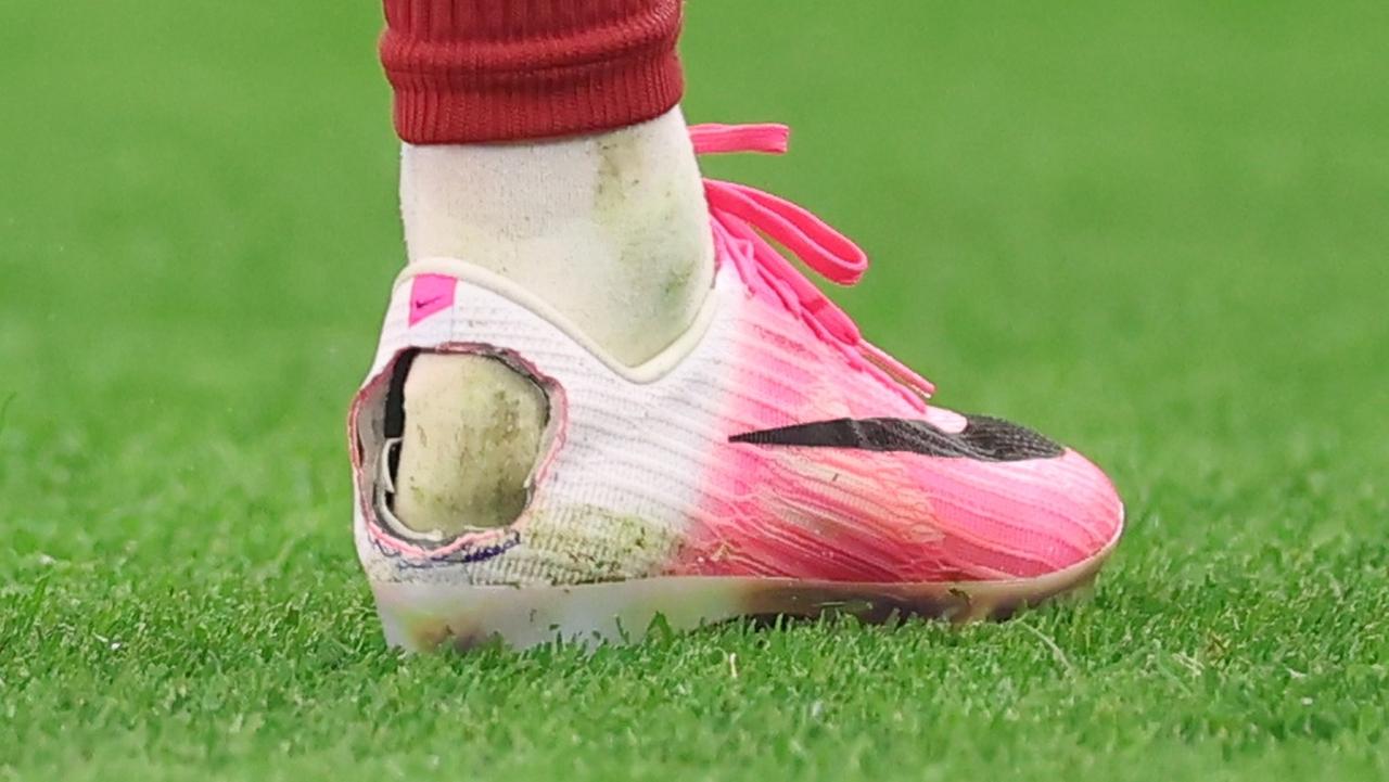 画像: ロナウド同僚、W杯でスパイクに穴を開けていた理由…かかとの病変の可能性 - Qoly-Sports&the Style