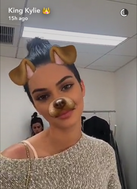 ケンダル・ジェナー Kendall Jenner 整形疑惑